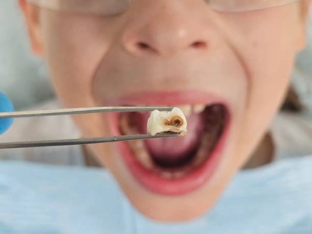 Best Pediatric Emergency Dentist in Olcott, NY