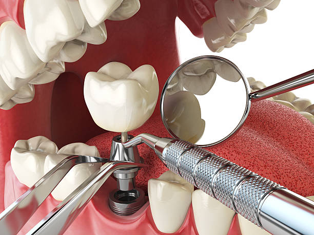 Best Emergency Treatment for Toothache in Olcott, NY